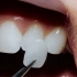 Esthetic dentistry
