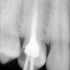 Endodontics